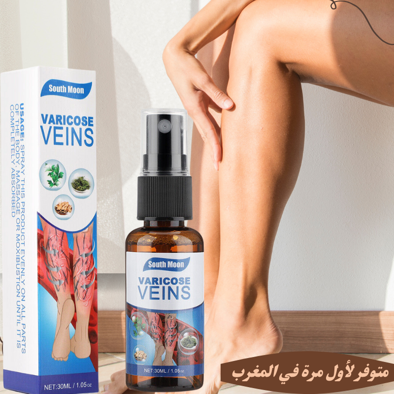 علاج الدوالي بدون جراحة